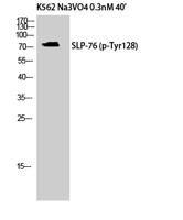 SLP-76 (phospho Tyr128) Polyclonal Antibody