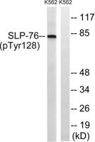 SLP-76 (phospho Tyr128) Polyclonal Antibody