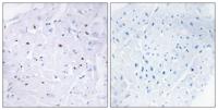 Smad3 (phospho Thr179) Polyclonal Antibody