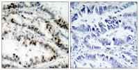 SMC1 (phospho Ser957) Polyclonal Antibody