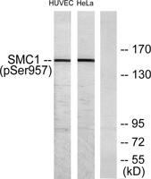 SMC1 (phospho Ser957) Polyclonal Antibody