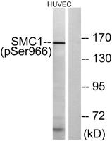 SMC1 (phospho Ser966) Polyclonal Antibody