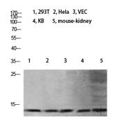 Histone H4 (Mono Methyl Lys21) Polyclonal Antibody