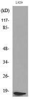 Acetyl eIF5A/eIF5A2 (K47) Polyclonal Antibody