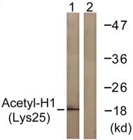 Acetyl Histone H1 (K25) Polyclonal Antibody