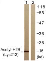 Acetyl Histone H2B (K12) Polyclonal Antibody