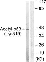 p53 (Acetyl K319) Polyclonal Antibody