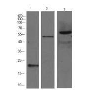 Acetyl Lysine Monoclonal Antibody(10B10)