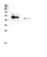 GATA-2/3 (Acetyl Lys336/304) Polyclonal Antibody