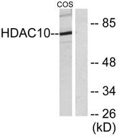 Histone deacetylase 10 Polyclonal Antibody