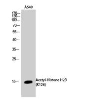 Histone H2B (Acetyl Lys126) Polyclonal Antibody