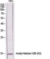 Histone H2B (Acetyl Lys5) Polyclonal Antibody