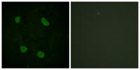 Histone H3 (Acetyl Lys14) Polyclonal Antibody