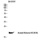 Histone H3 (Acetyl Lys18) Polyclonal Antibody