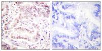 Histone H3 (Acetyl Lys27) Polyclonal Antibody