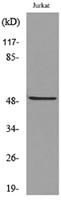 HNF-3α/β/γ (Acetyl Lys264/253/211) Polyclonal Antibody