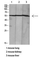 HNF-4α/γ (Acetyl Lys127/79) Polyclonal Antibody