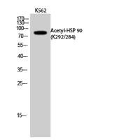 HSP 90 (Acetyl Lys292/284) Polyclonal Antibody