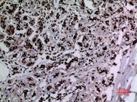 HSP 90 (Acetyl Lys292/284) Polyclonal Antibody