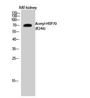 HSP70 (Acetyl Lys246) Polyclonal Antibody