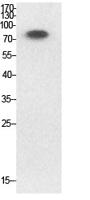 Ub (Acetyl Lys33) Polyclonal Antibody