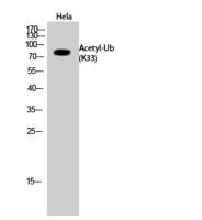 Ub (Acetyl Lys33) Polyclonal Antibody