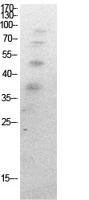 Ub (Acetyl Lys27) Polyclonal Antibody