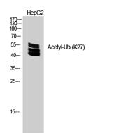 Ub (Acetyl Lys27) Polyclonal Antibody