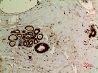 Ub (Acetyl Lys27) Polyclonal Antibody