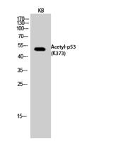 p53 (Acetyl Lys373) Polyclonal Antibody