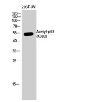 p53 (Acetyl Lys382) Polyclonal Antibody