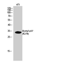 p57 (Acetyl Lys278) Polyclonal Antibody