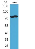 p73 (Acetyl Lys327) Polyclonal Antibody