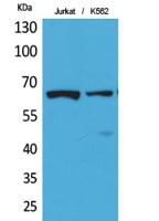 NFκB-p65 (Acetyl Lys218) Polyclonal Antibody