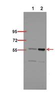 NFκB-p65 (Acetyl Lys218) Polyclonal Antibody