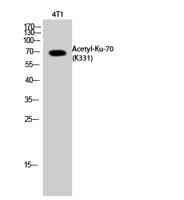 Ku-70 (Acetyl Lys331) Polyclonal Antibody