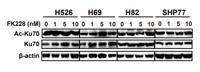 Ku-70 (Acetyl Lys539) Polyclonal Antibody