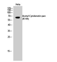 Cytokeratin-pan (Acetyl Lys194) Polyclonal Antibody