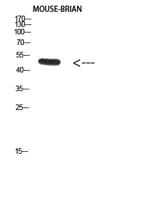 E2F-1 (Acetyl Lys120) Polyclonal Antibody