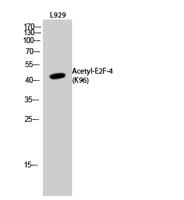 E2F-4 (Acetyl Lys96) Polyclonal Antibody