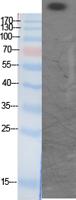 CREB-BP (Acetyl Lys1535) Polyclonal Antibody