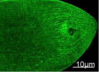 Myosin Heavy Chain Monoclonal Antibody(11C2)