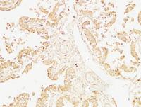 Cystatin C mouse Monoclonal Antibody(7F11)