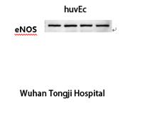 eNOS Monoclonal Antibody(Mix)