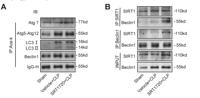 ATG5 (PTR1362) mouse mAb