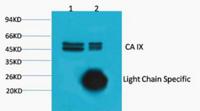 CA IX Monoclonal Antibody(12F10)