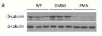 Catenin-β Monoclonal Antibody(4F2)