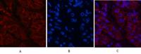 Catenin-β Monoclonal Antibody(4F2)