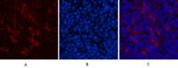 Catenin-β Monoclonal Antibody(4F2)