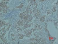 Catenin-β Monoclonal Antibody(4F2)